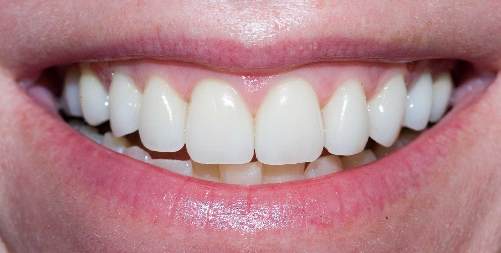 Cosmetic Dentistry Christchurch Robinson s Dental Practice